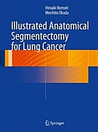 Illustrated Anatomical Segmentectomy for Lung Cancer (Hardcover, 2012)