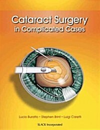 Cataract Surgery in Complicated Cases (Hardcover, New)