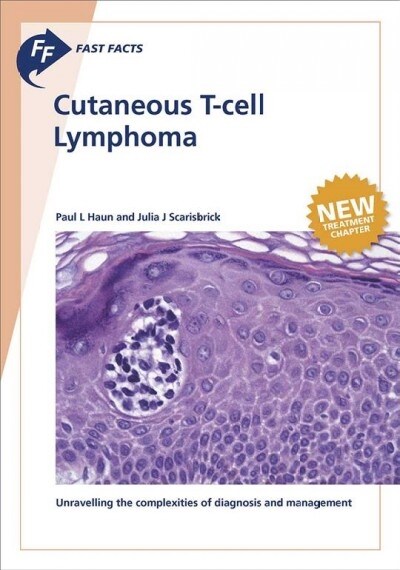 Fast Facts: Cutaneous T-Cell Lymphoma (Paperback)