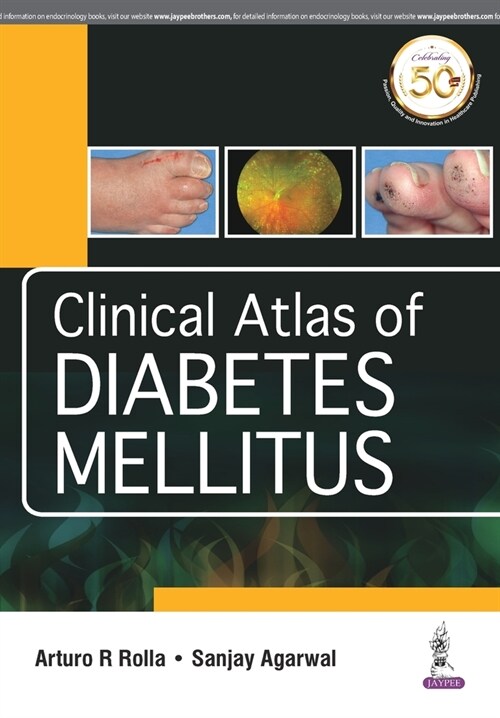 Clinical Atlas of Diabetes Mellitus (Paperback)