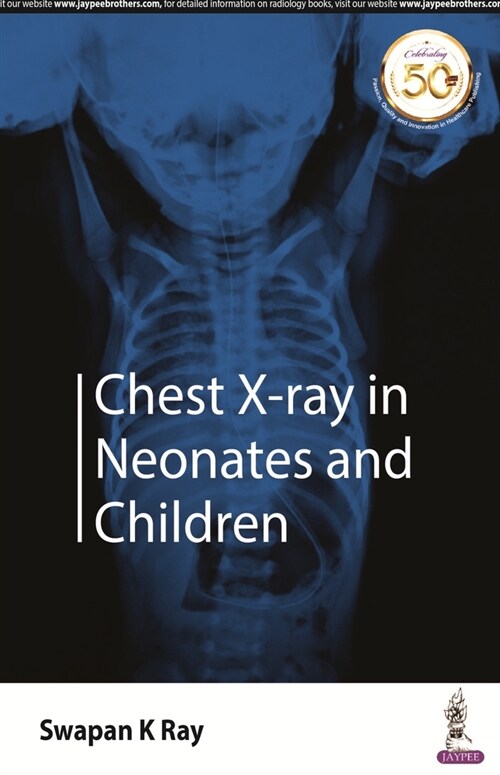 Chest X-Ray in Neonates and Children (Paperback)