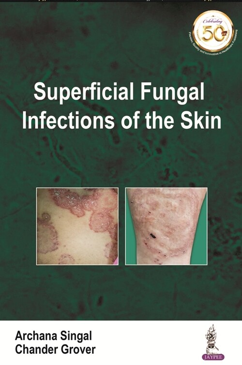 Superficial Fungal Infections of the Skin (Paperback)