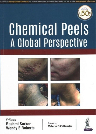 Chemical Peels: A Global Perspective (Paperback)