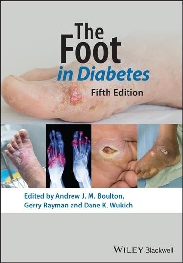 The Foot in Diabetes (Hardcover)