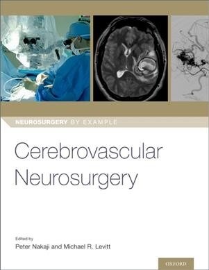 Cerebrovascular Neurosurgery (Paperback)