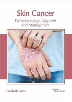 Skin Cancer: Pathophysiology, Diagnosis and Management (Hardcover)