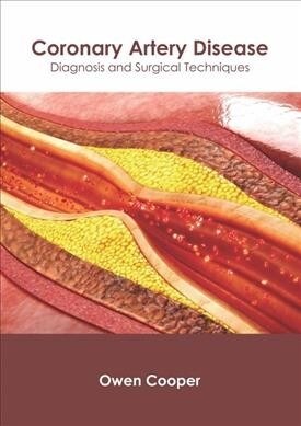 Coronary Artery Disease: Diagnosis and Surgical Techniques (Hardcover)