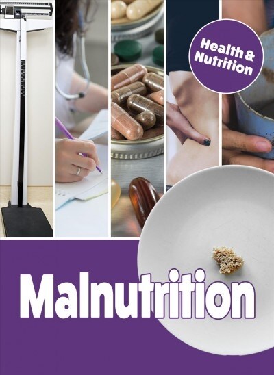 Malnutrition (Hardcover)