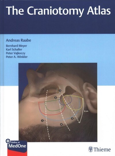 The Craniotomy Atlas (Hardcover)