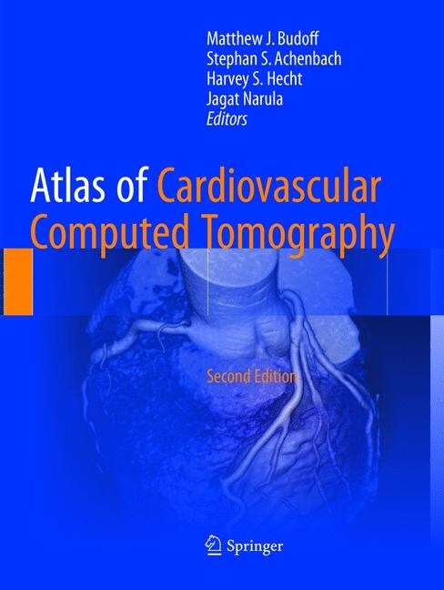 Atlas of Cardiovascular Computed Tomography (Paperback, Softcover reprint of the original 2nd ed. 2018)