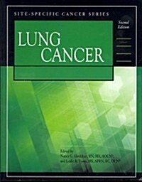 Lung Cancer (Paperback, 2)