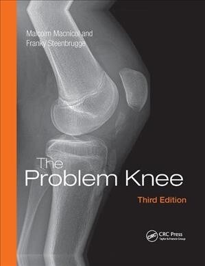 The Problem Knee (Paperback, 3 ed)