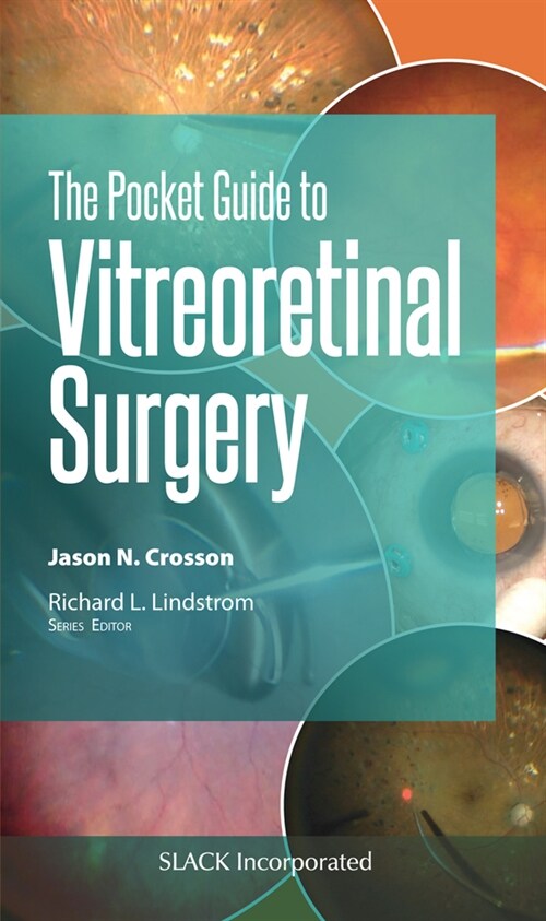 The Pocket Guide to Vitreoretinal Surgery (Paperback)