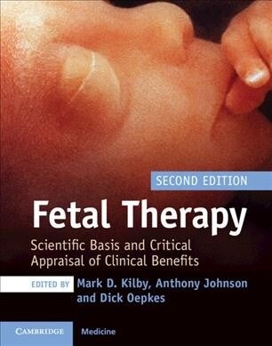 Fetal Therapy : Scientific Basis and Critical Appraisal of Clinical Benefits (Hardcover, 2 Revised edition)