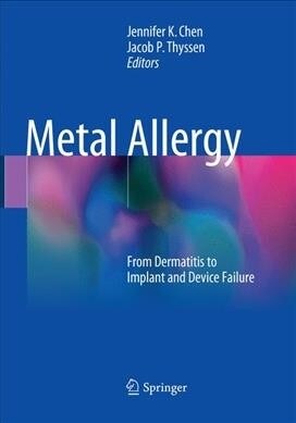 Metal Allergy: From Dermatitis to Implant and Device Failure (Paperback, Softcover Repri)