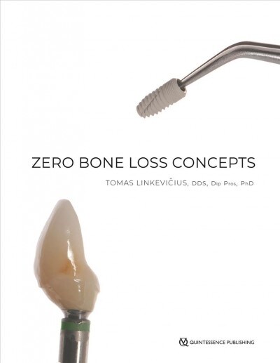 Zero Bone Loss Concepts (Hardcover)