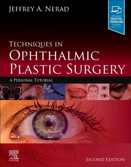 Techniques in Ophthalmic Plastic Surgery: A Personal Tutorial (Hardcover, 2)
