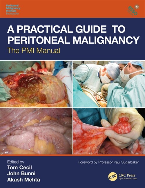 A Practical Guide to Peritoneal Malignancy : The PMI Manual (Hardcover)