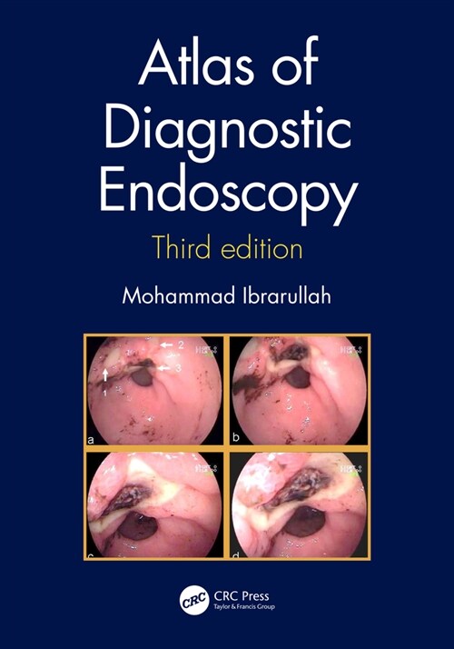 Atlas of Diagnostic Endoscopy, 3E (Hardcover, 3 ed)