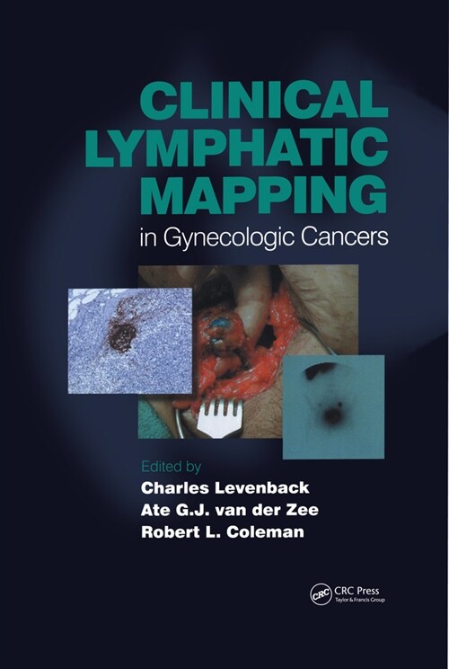 Clinical Lymphatic Mapping of Gynecologic Cancer (Hardcover, 1)