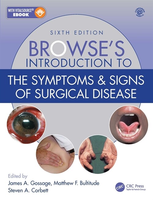 Browses Introduction to the Symptoms & Signs of Surgical Disease (Hardcover, 6 ed)