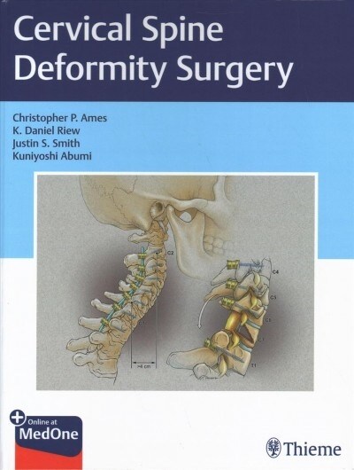 Cervical Spine Deformity Surgery (Hardcover)