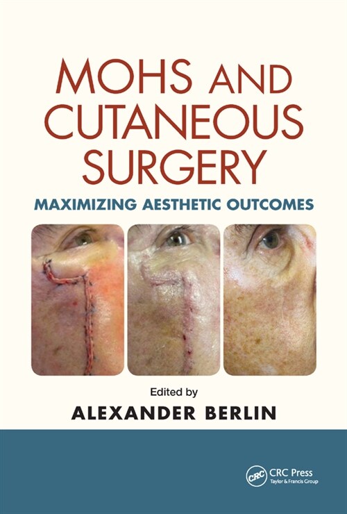 Mohs and Cutaneous Surgery : Maximizing Aesthetic Outcomes (Paperback)