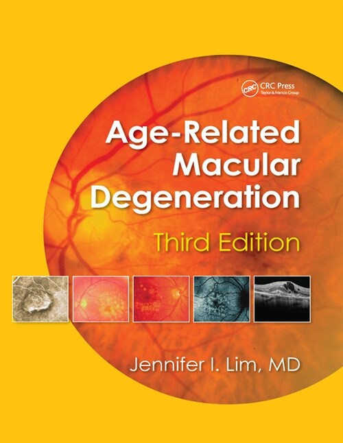 Age-Related Macular Degeneration, Third Edition (Paperback, 3 ed)