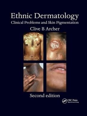 Ethnic Dermatology : Clinical Problems and Skin Pigmentation (Paperback, 2 ed)