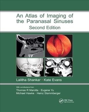 Atlas of Imaging of the Paranasal Sinuses, Second Edition (Paperback, 2 ed)