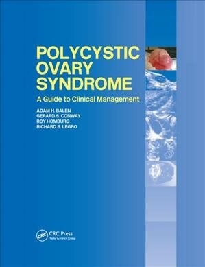 Polycystic Ovary Syndrome : A Guide to Clinical Management (Paperback)