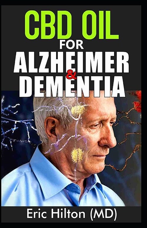 CBD Oil for Alzheimer and Dementia: Your Guide on Alzheimers and Dementia Disease And How CBD Oil Can Help To Reverse it. The Dosage, Uses, Side Effe (Paperback)