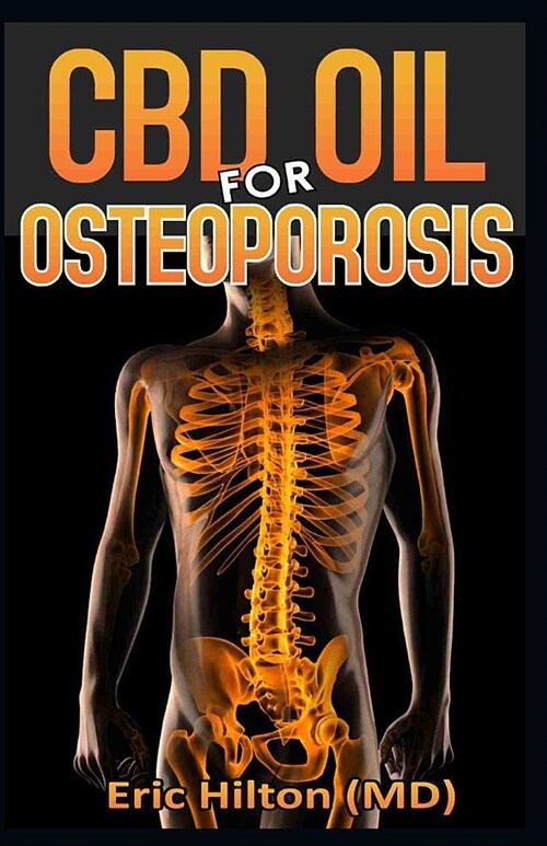 CBD Oil for Osteoporosis: Essential Remedy and Alternative Therapy for OSTEOPOROSIS (Paperback)
