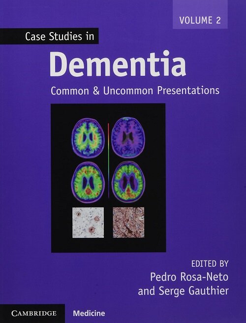 Case Studies in Dementia : Common and Uncommon Presentations (Paperback)