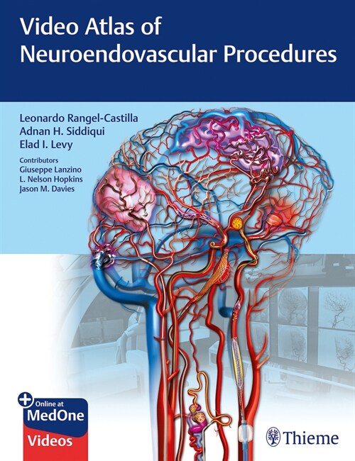 Video Atlas of Neuroendovascular Procedures (Hardcover)