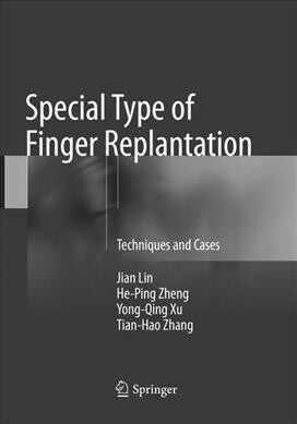 Special Type of Finger Replantation: Techniques and Cases (Paperback, Softcover Repri)