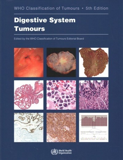 Digestive System Tumours: Who Classification of Tumours (Paperback, 5)
