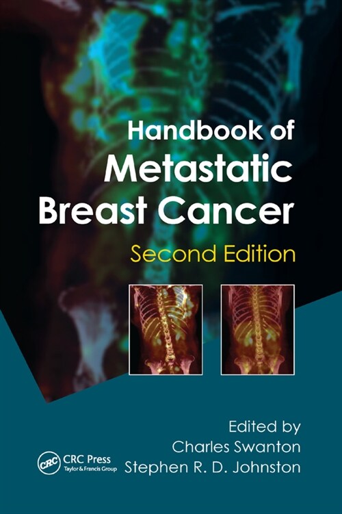 Handbook of Metastatic Breast Cancer (Paperback, 2 ed)