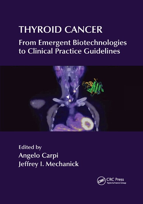 Thyroid Cancer : From Emergent Biotechnologies to Clinical Practice Guidelines (Paperback)