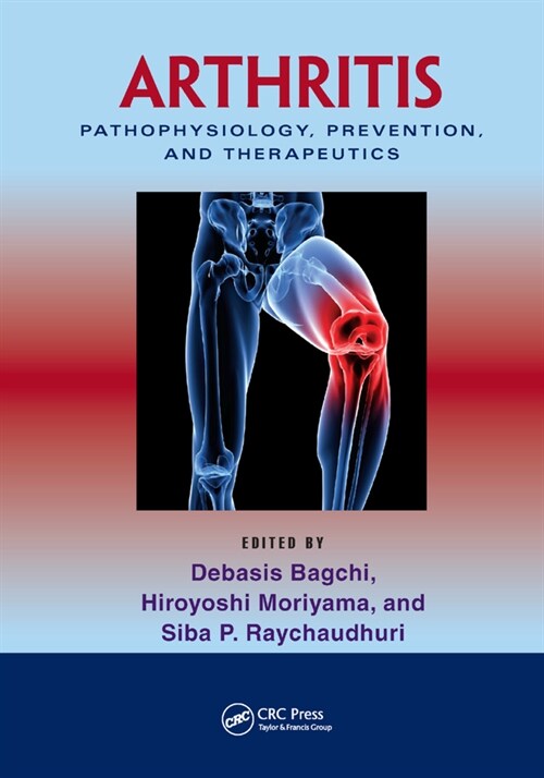 Arthritis : Pathophysiology, Prevention, and Therapeutics (Paperback)