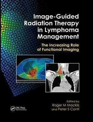 Image-Guided Radiation Therapy in Lymphoma Management : The Increasing Role of Functional Imaging (Paperback)