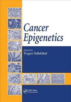 Cancer Epigenetics (Paperback, 1)