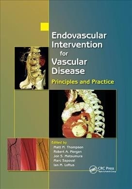 Endovascular Intervention for Vascular Disease : Principles and Practice (Paperback)