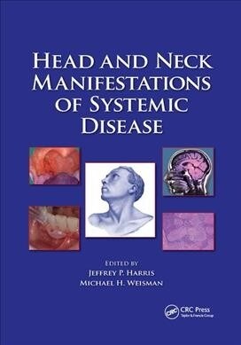 Head and Neck Manifestations of Systemic Disease (Paperback, 1)