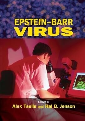 Epstein-Barr Virus (Paperback, 1)