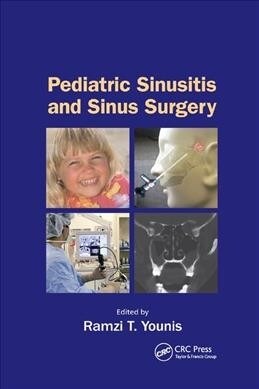 Pediatric Sinusitis and Sinus Surgery (Paperback, 1)