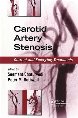 Carotid Artery Stenosis : Current and Emerging Treatments (Paperback)