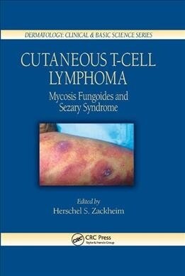 Cutaneous T-Cell Lymphoma : Mycosis Fungoides and Sezary Syndrome (Paperback)