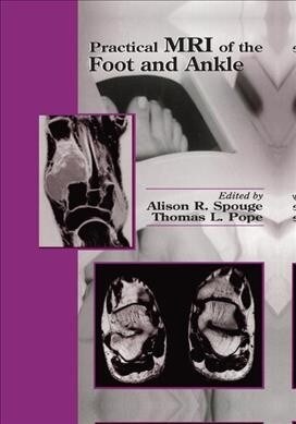 Practical MRI of the Foot and Ankle (Paperback, 1)