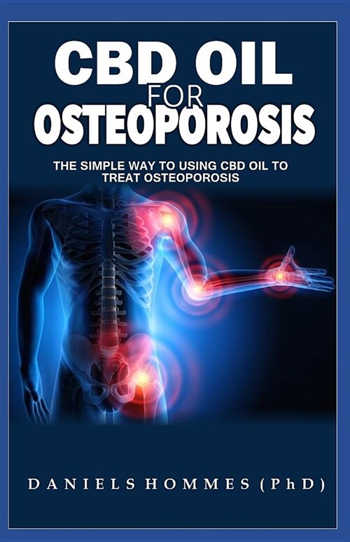 CBD Oil for Osteoporosis: Basic Guide on Using CBD Oil to Cure Osteoporosis and Improve Bone Health (Paperback)